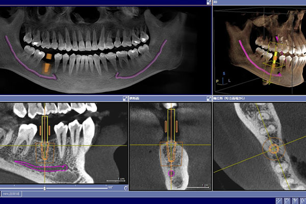 診断・治療計画の説明