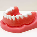 入れ歯