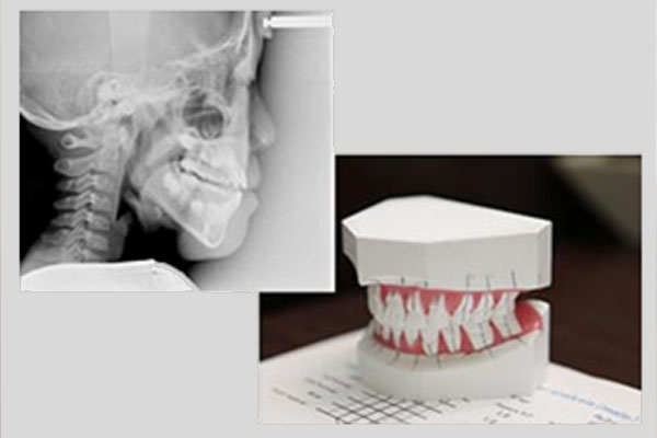 診断・治療計画の説明