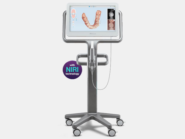 3D光学スキャナー「iTERO」