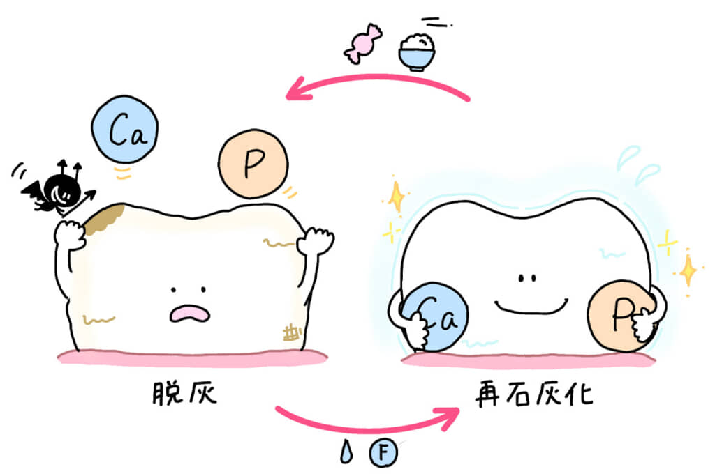 脱灰と再石灰化