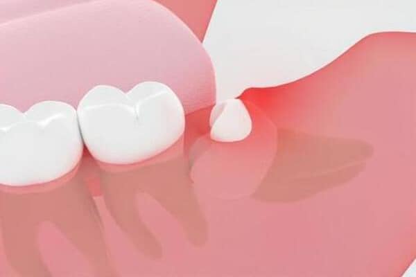 真っ直ぐに生えてこない